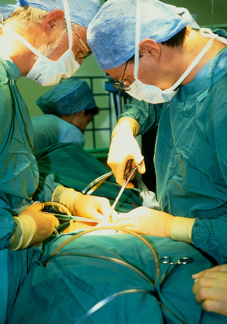 Surgeons performing a gall bladder removal