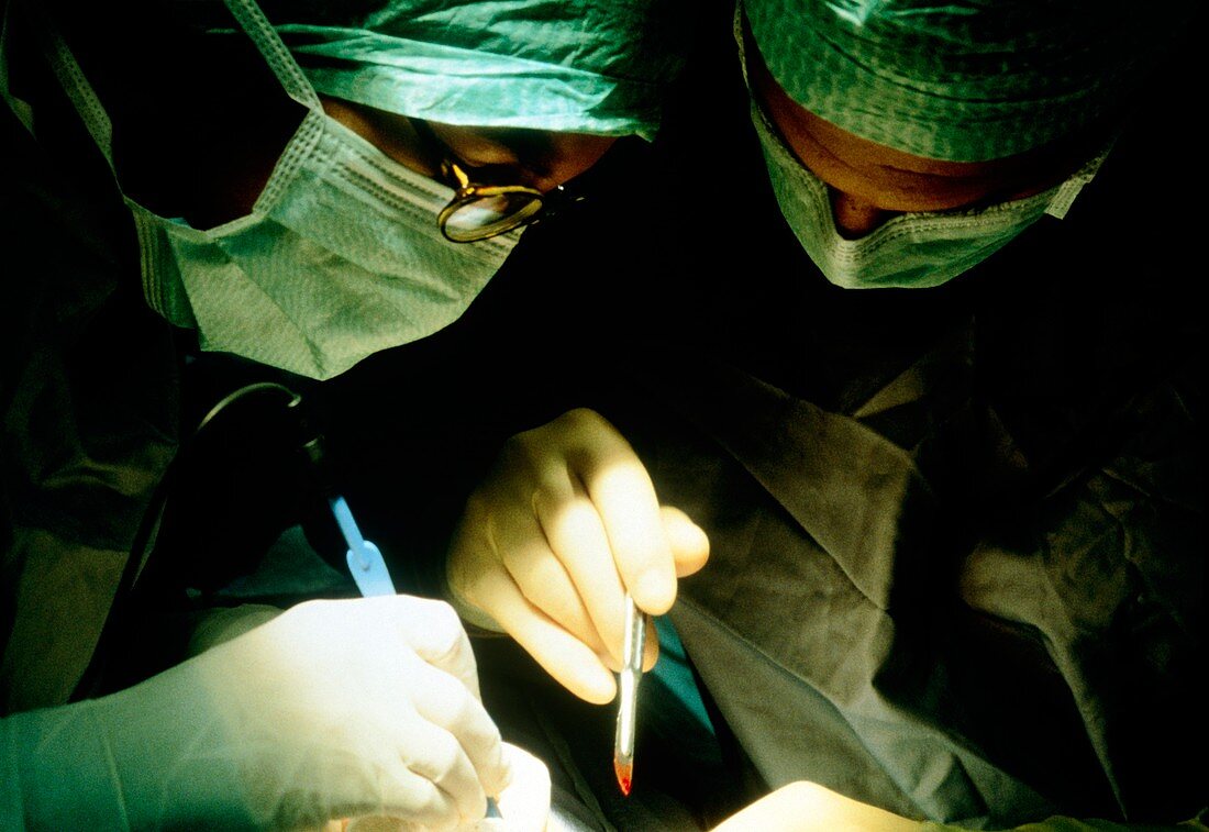 Surgeons operating on a cancerous breast