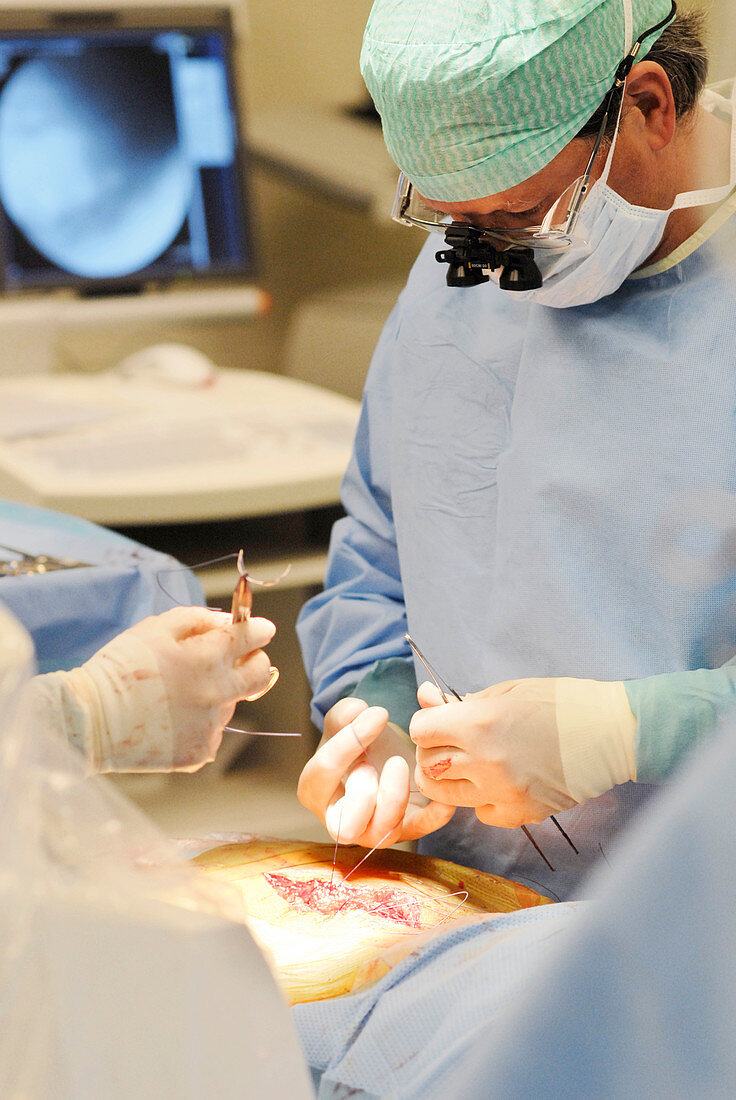 Spinal surgery