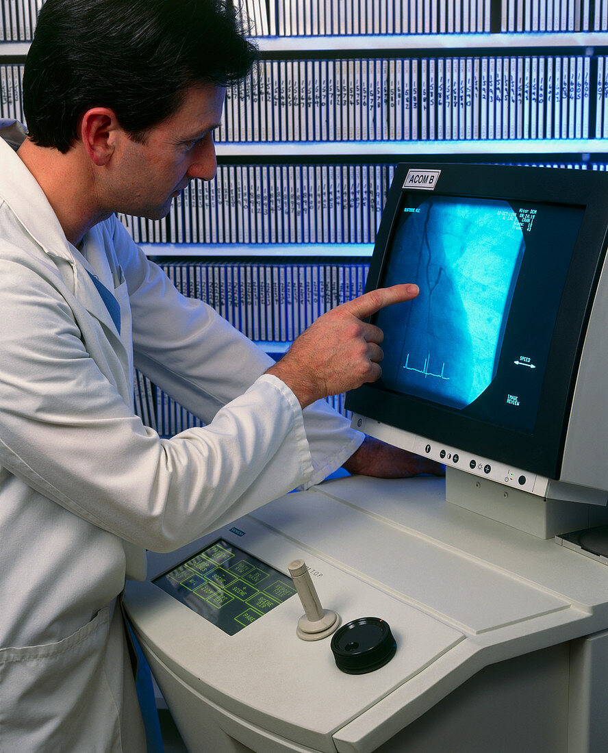 Radiographer studies CD record of an angiogram