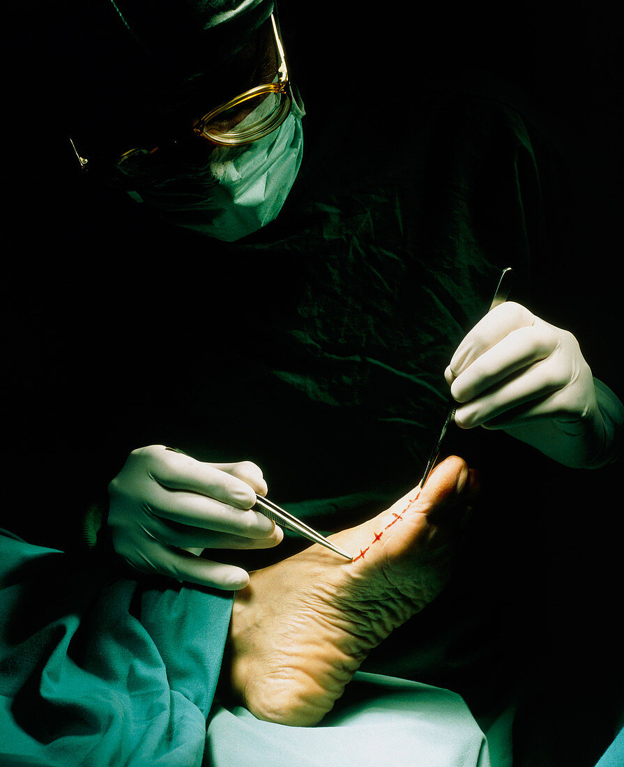 Orthopaedic surgeon examines foot before operation