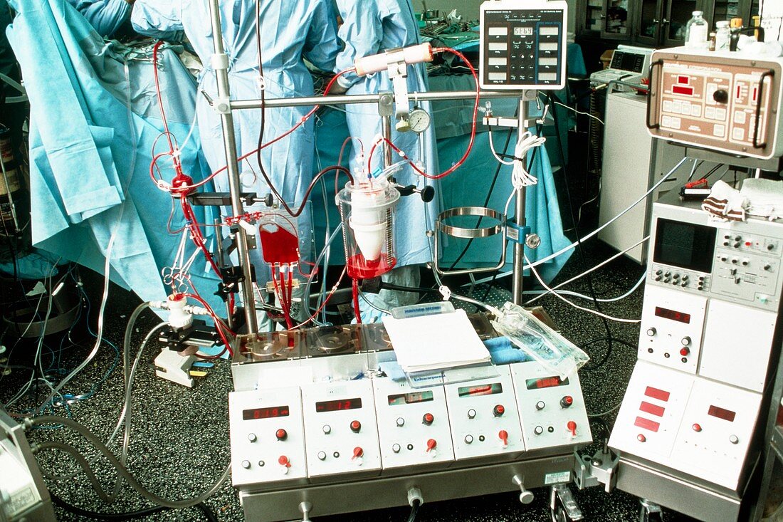 Paediatric heart transplant: heart/lung machine