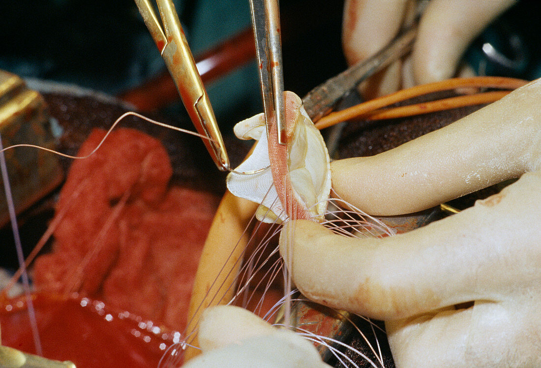 Heart valve operation