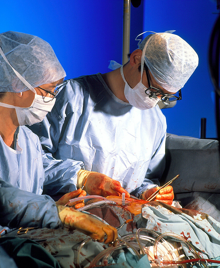 Surgeon completes triple bypass surgery on heart