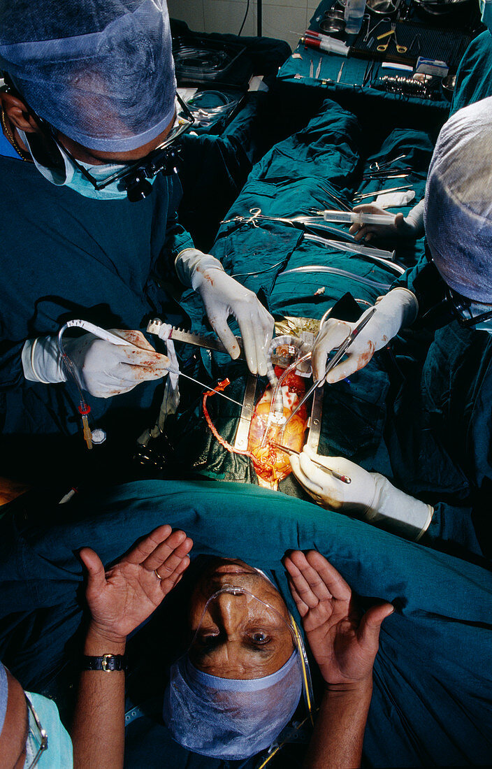 Heart surgery