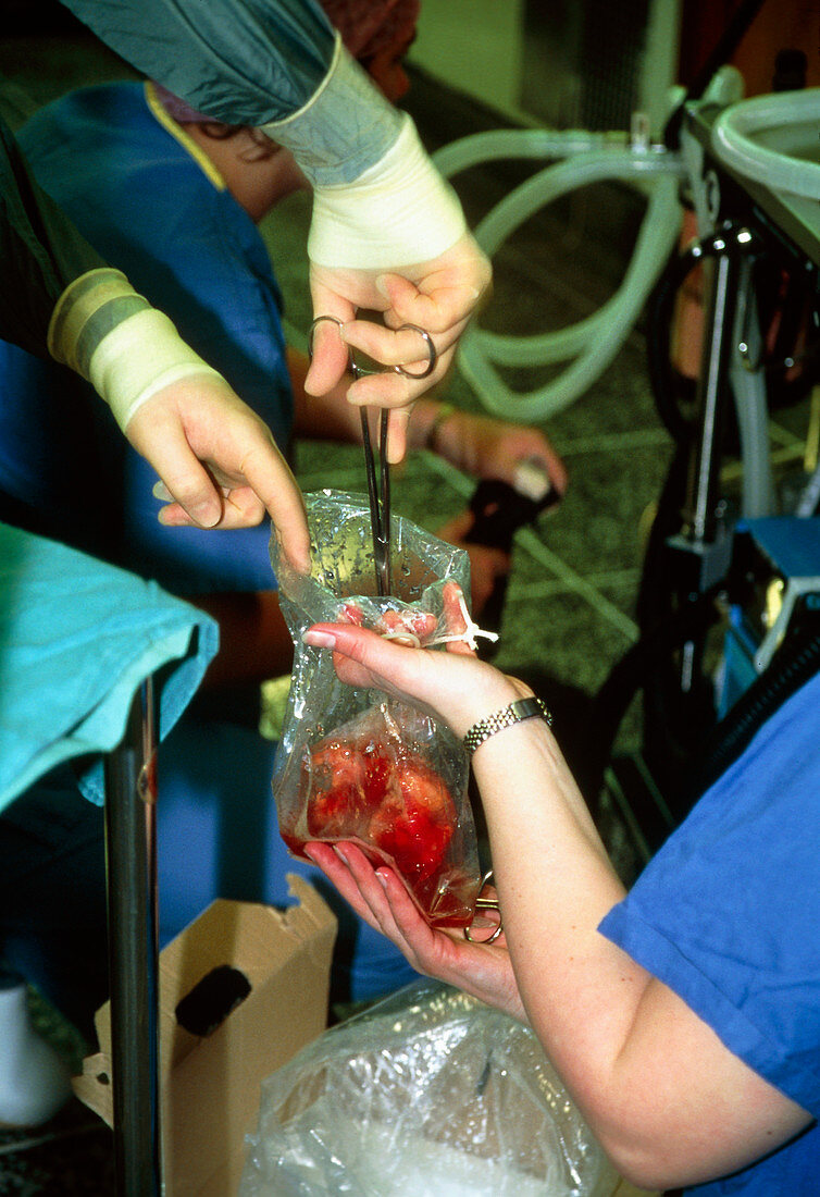 Surgeon removing a donor kidney from a plastic bag