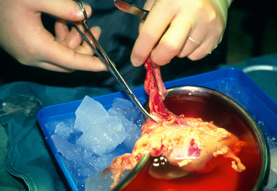 Surgeon preparing donor kidney for transplantation