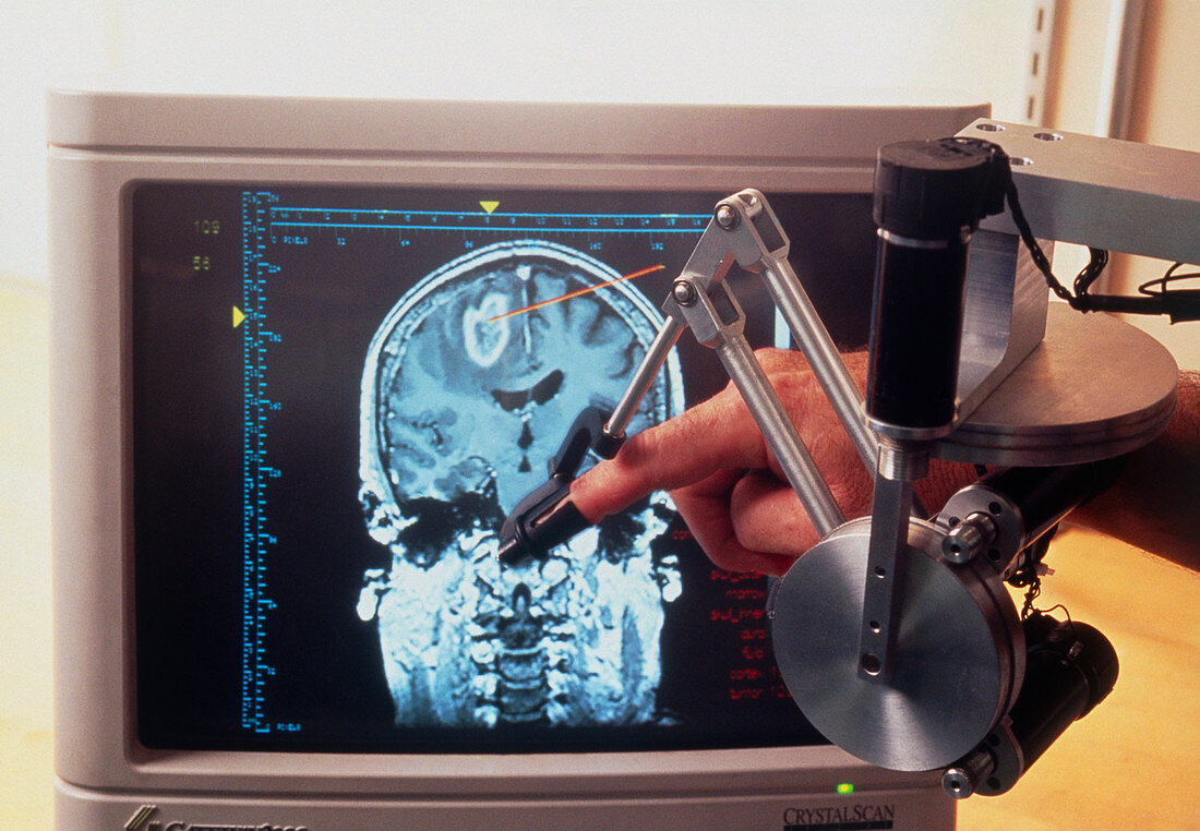 Phantom thimble & brain scan for training surgeons