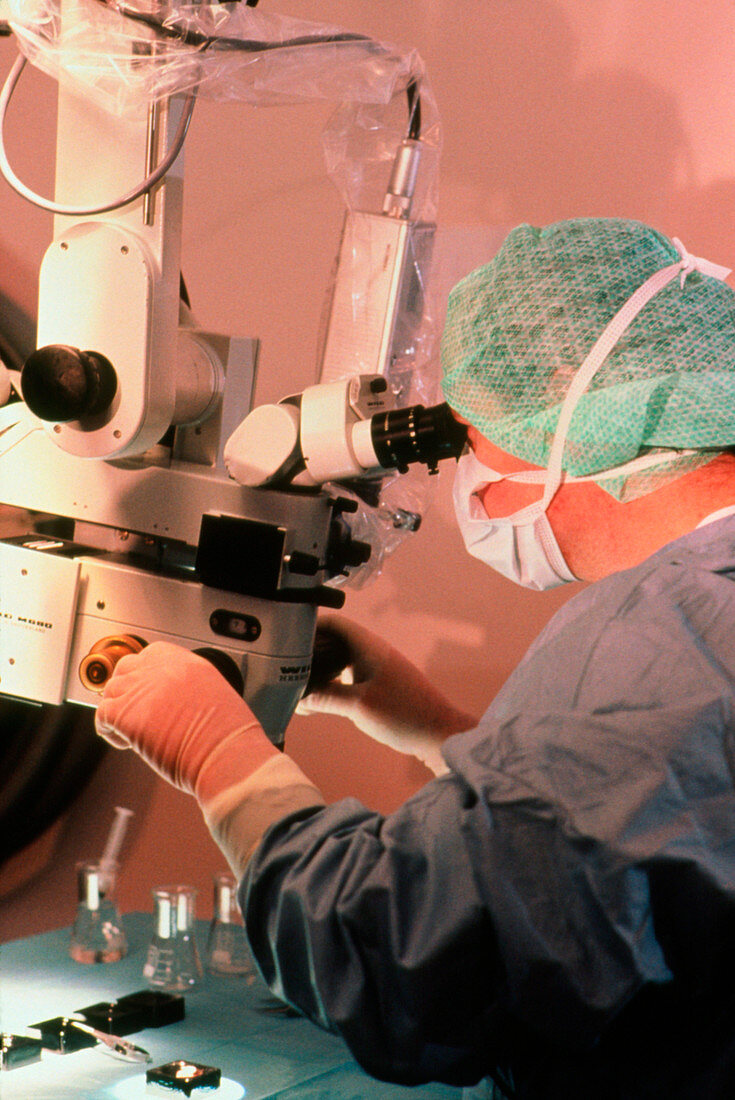 Parkinson's brain surgery extracting foetal cells