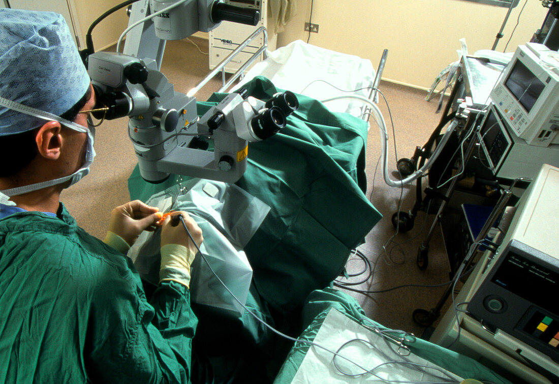 Surgeon removes cataracts using ultrasound