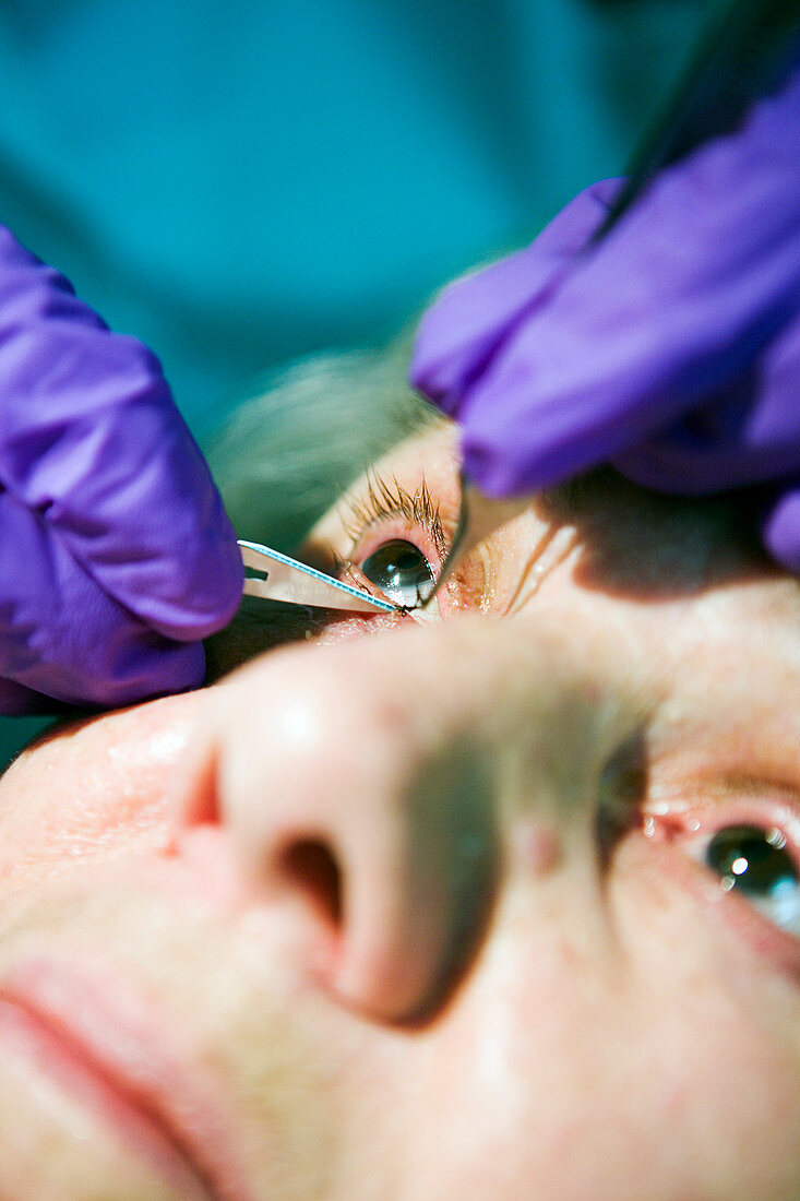 Eye surgery