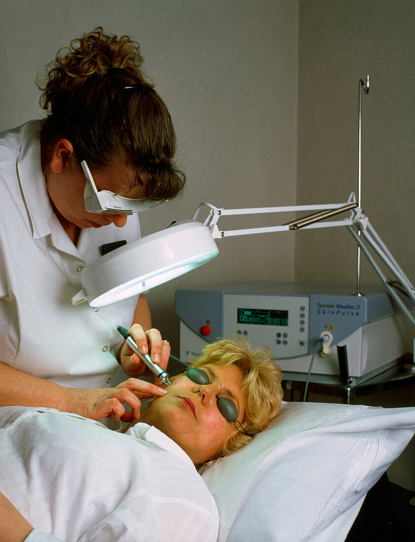 Cosmetic laser surgery