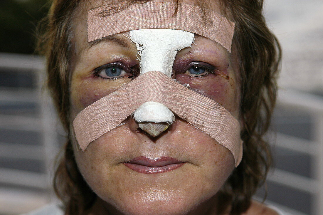 Nose and eye surgery