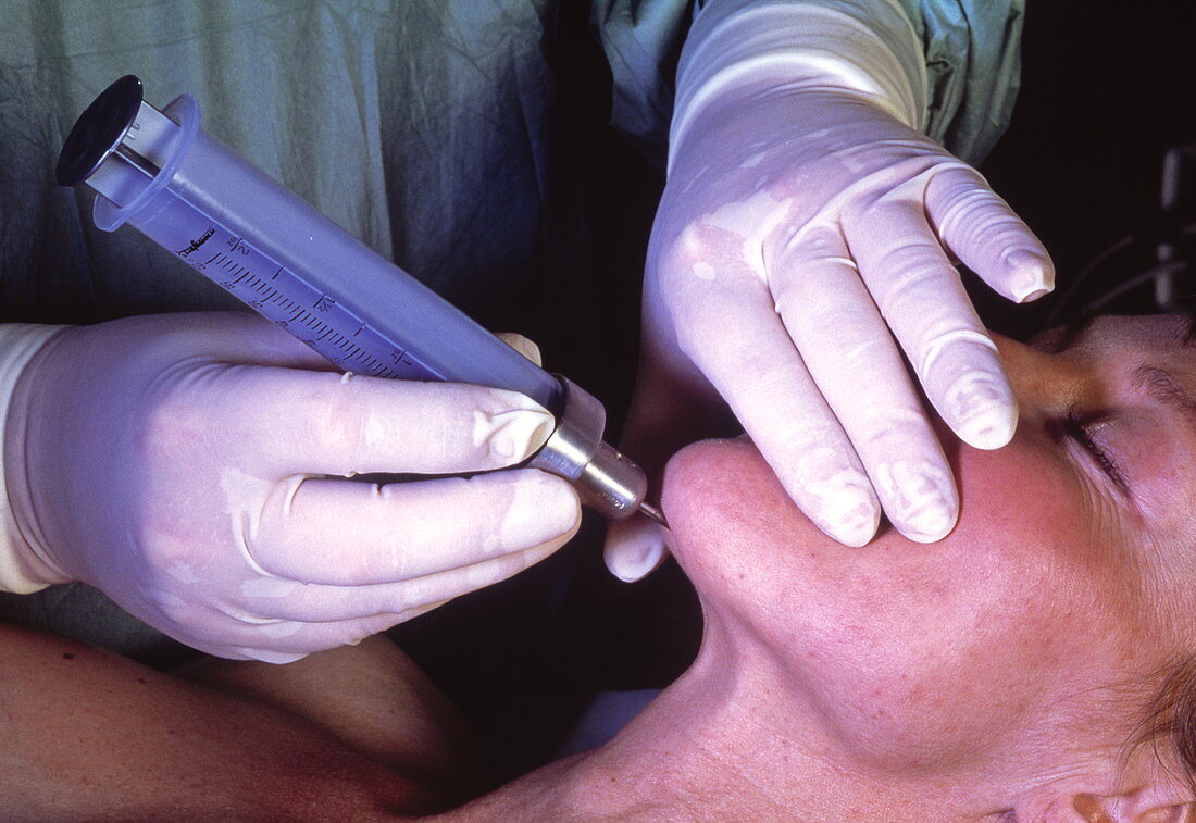 Surgeon conducting liposuction on patient's chin