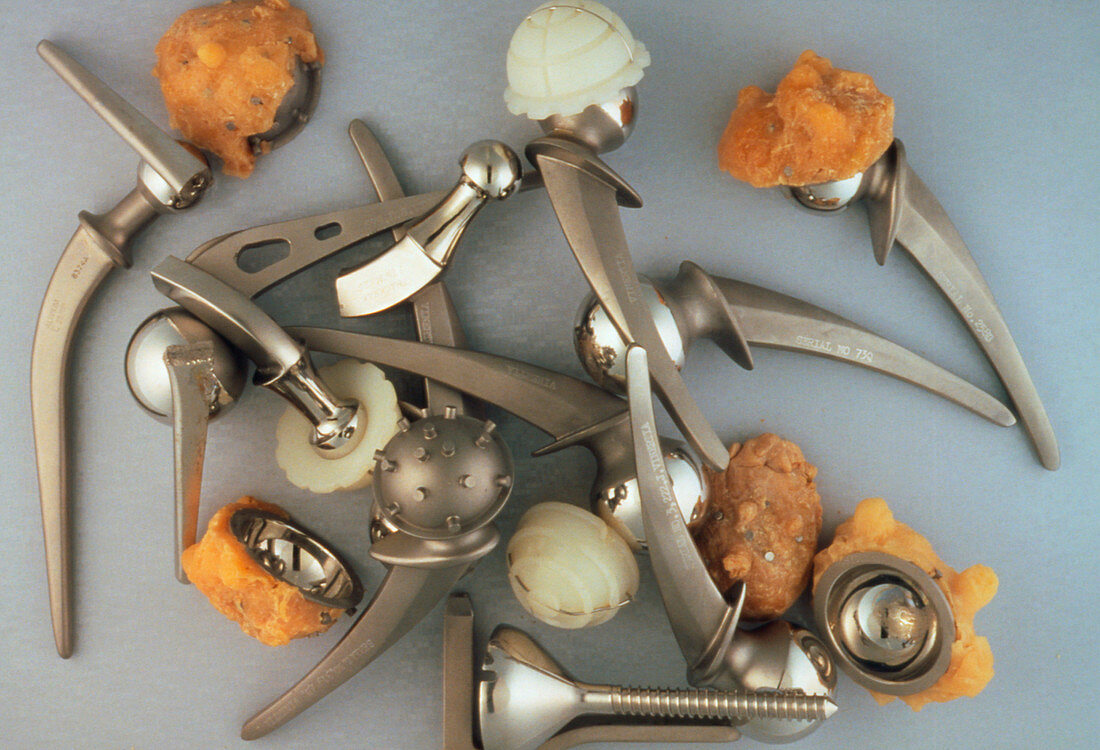 Selection of broken & used hip prostheses