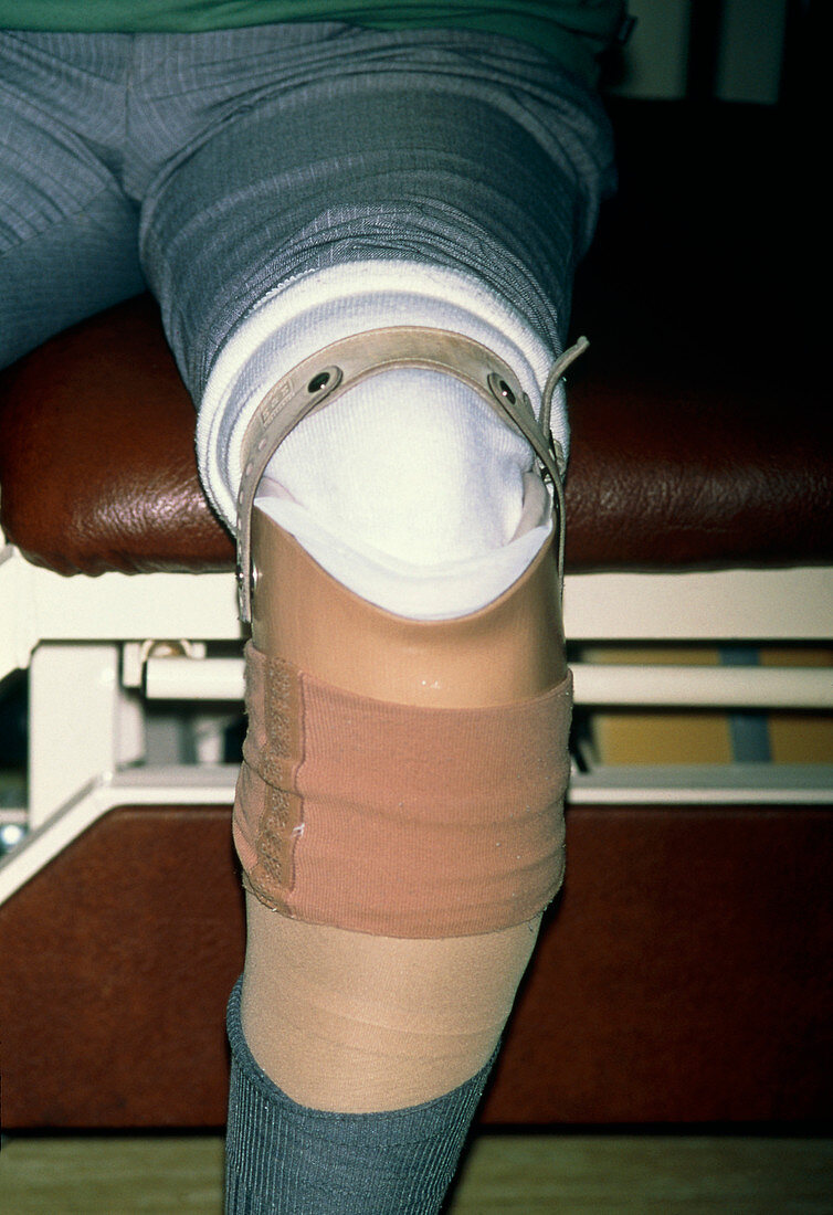 View of a man's artificial lower leg
