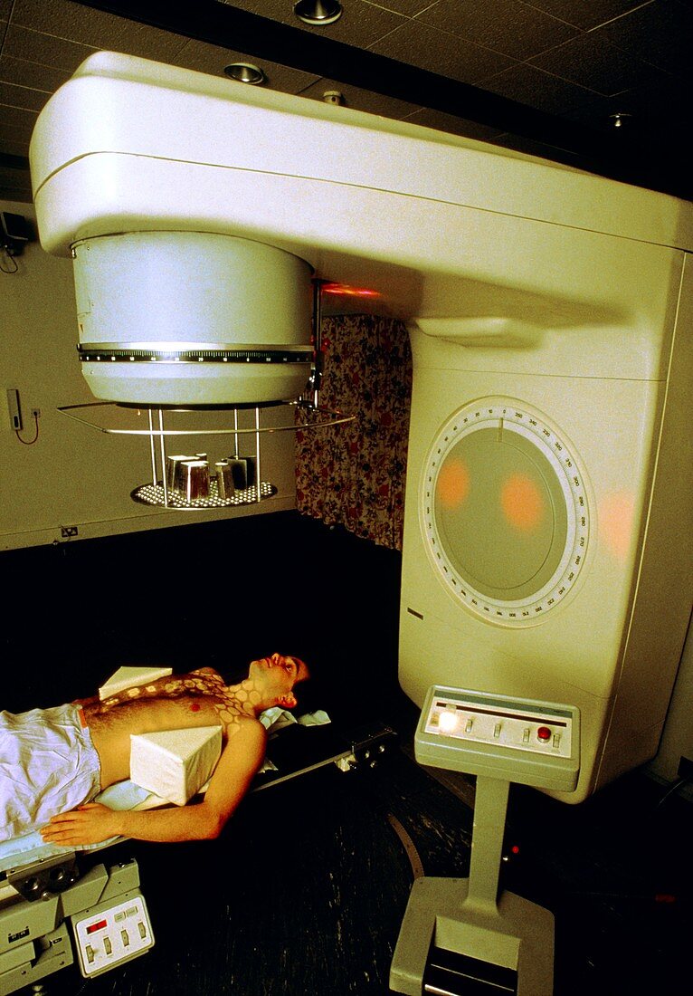 Person undergoing radiotherapy for Hodgkin's