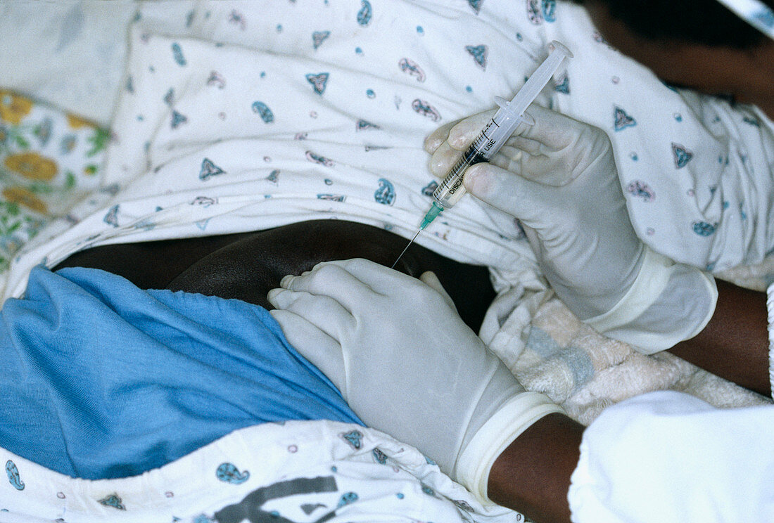 Tuberculosis treatment