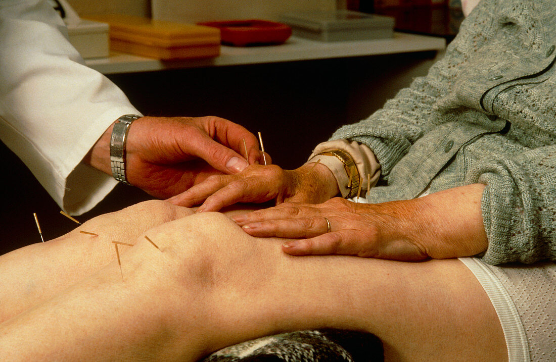 Acupuncturist applying needles to knees & hands