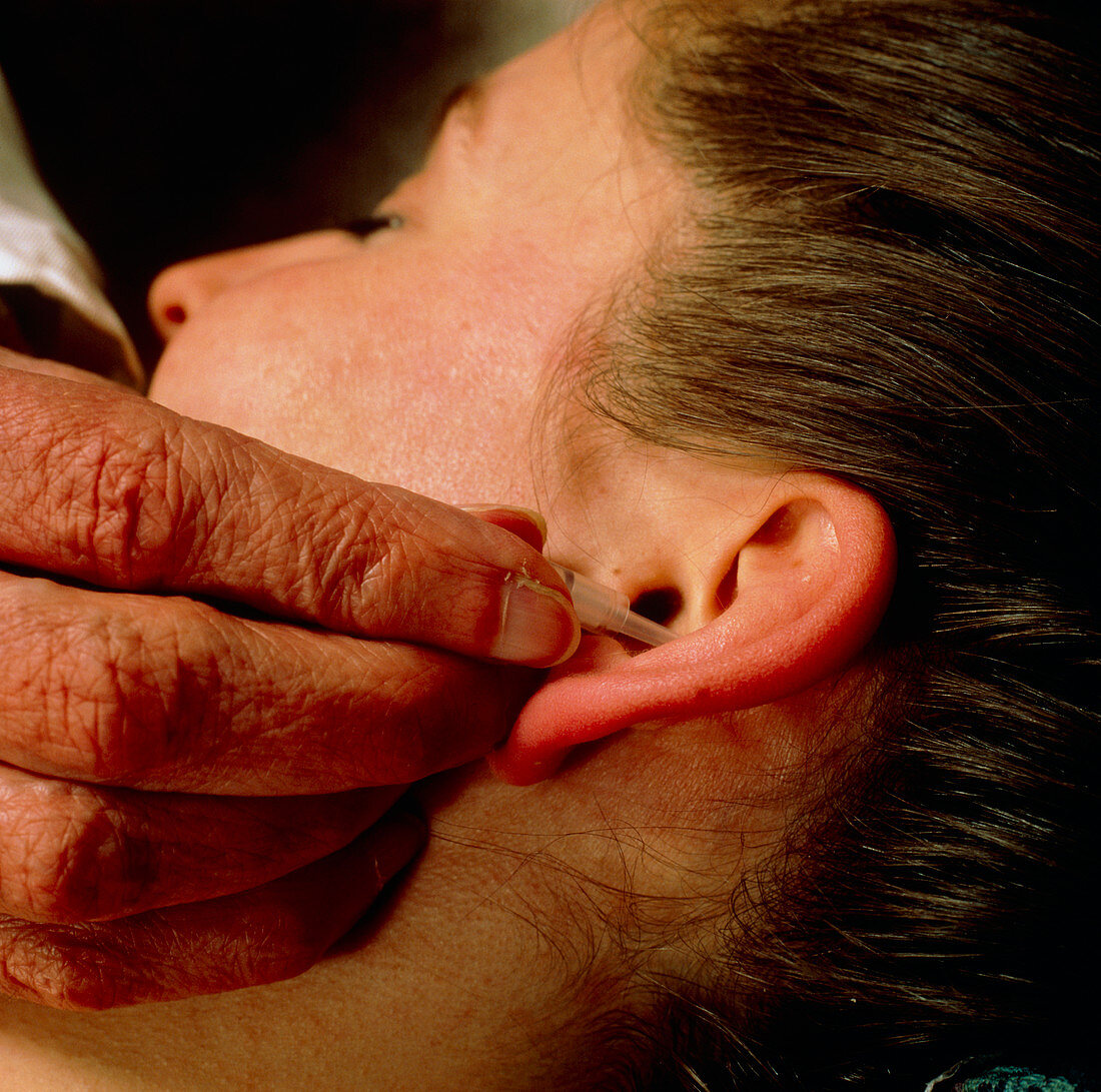Acupuncure in addiction: smoker's ear stud