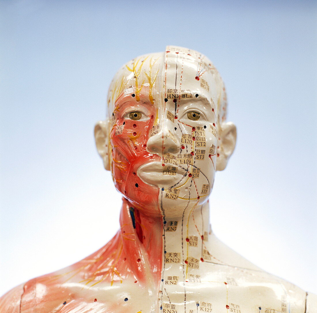 Acupuncture model