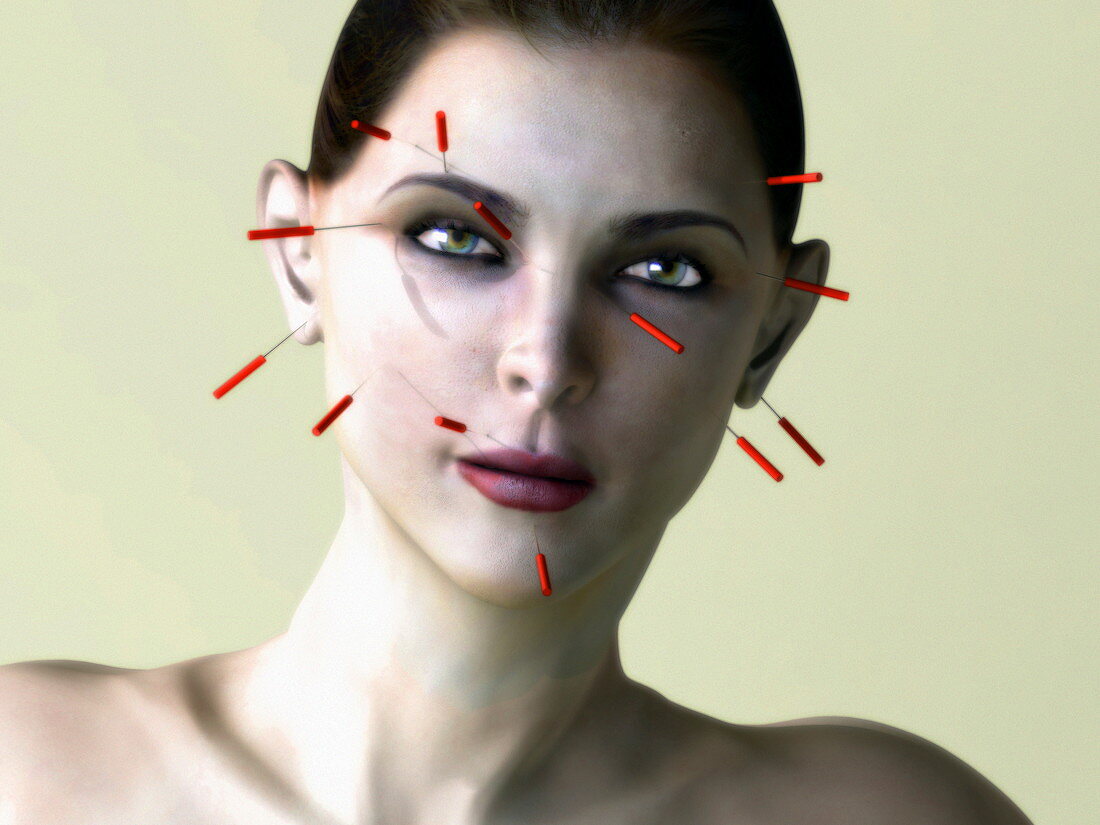 Facial acupuncture,artwork