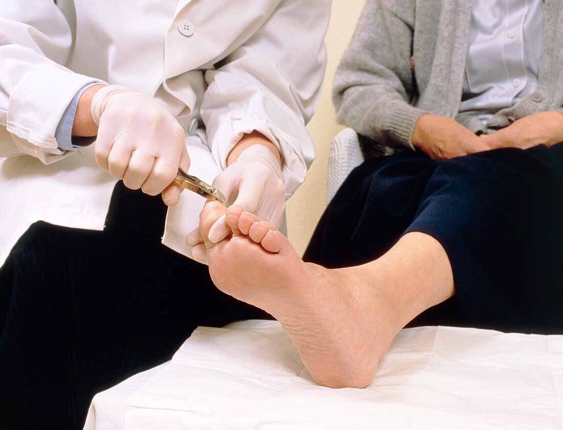 Chiropodist cuts the toenails of elderly patient