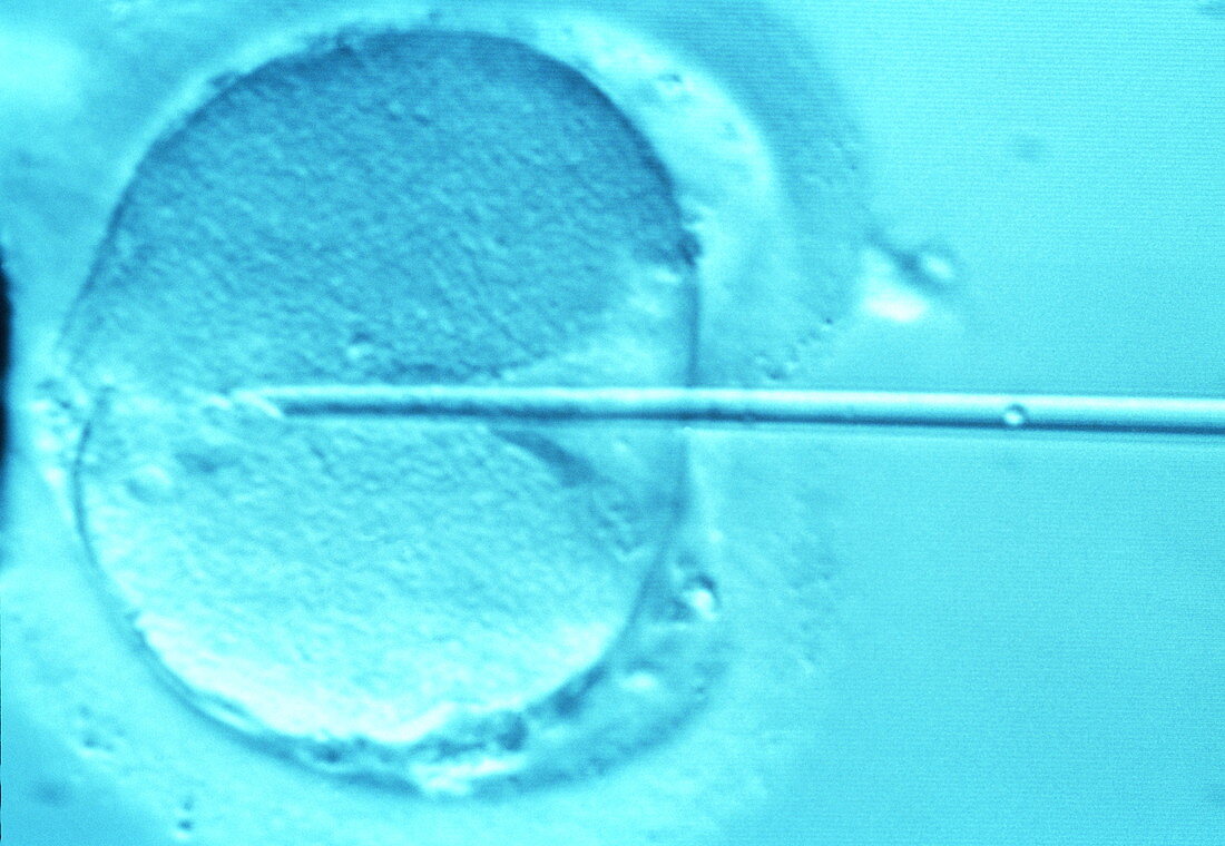 ICSI method of in vitro fertilization