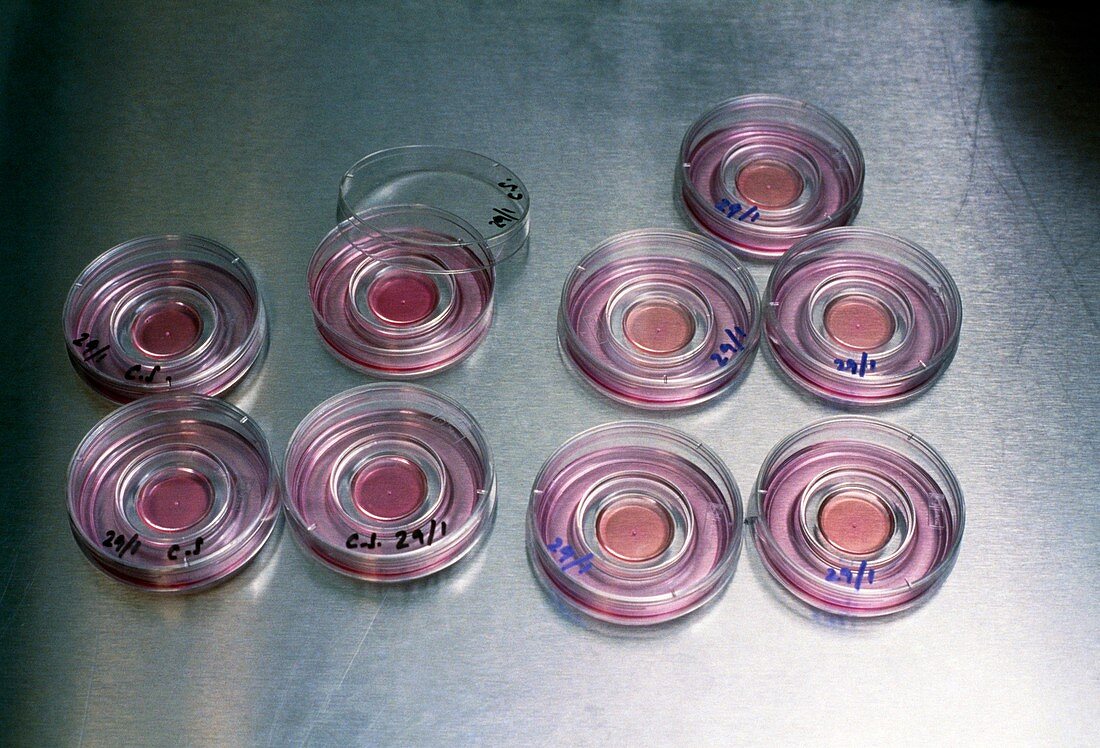 Petri dishes containing unfertislised human ova