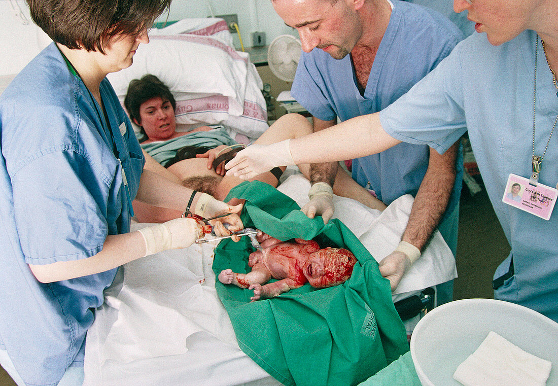 Midwife cutting an umbilical cord