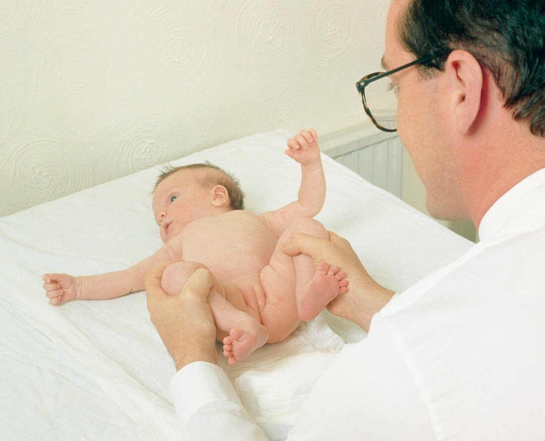 Doctor checking baby for hip deformity
