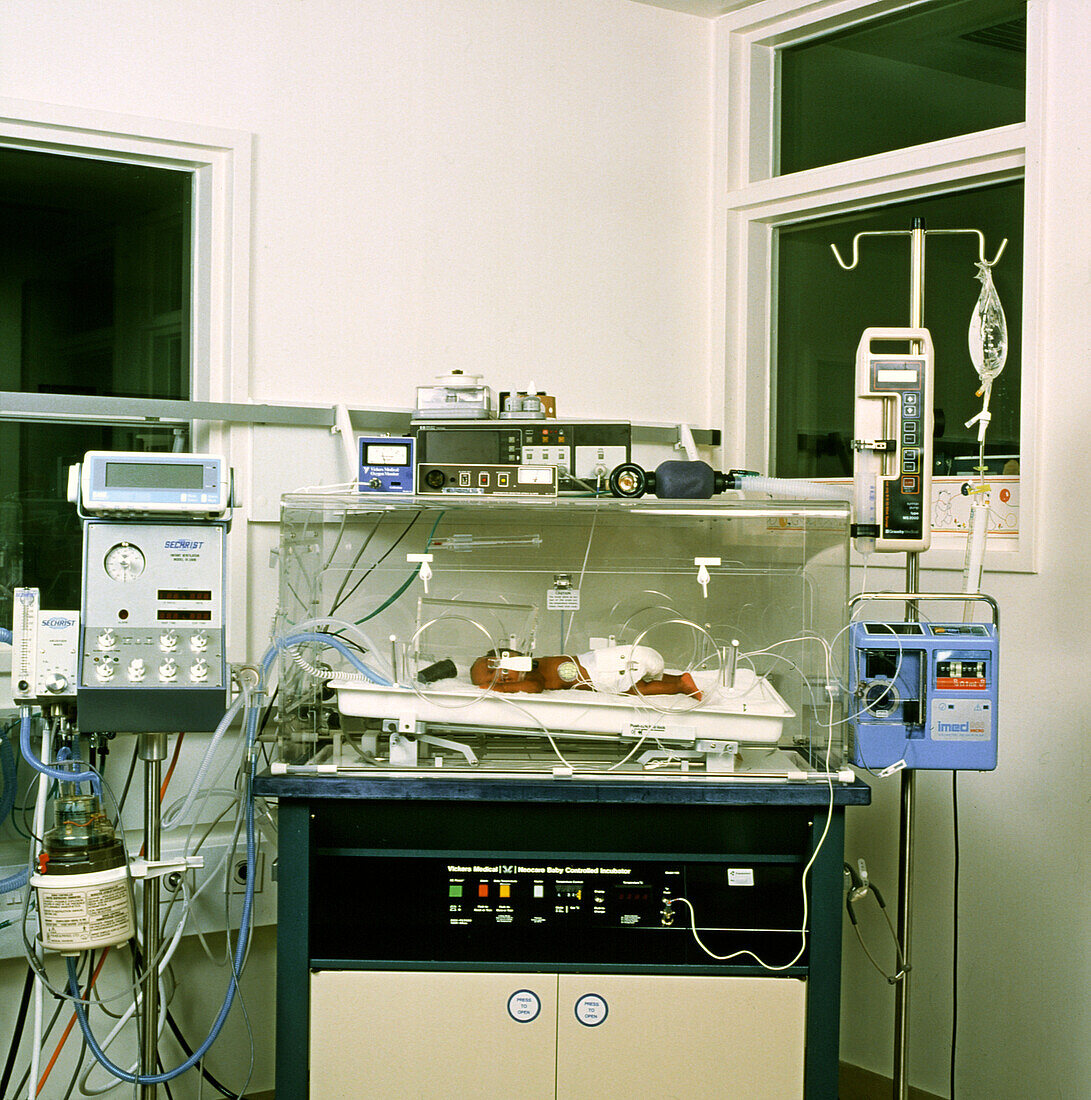 Newborn baby in an intensive care unit
