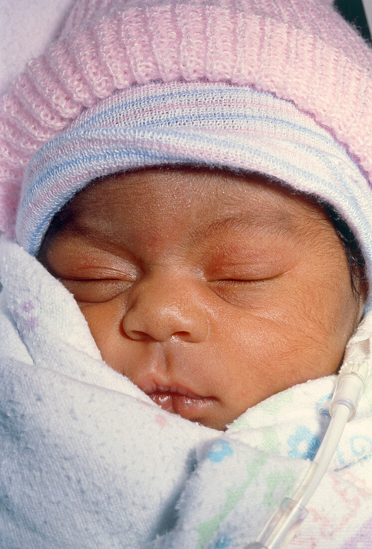Face of a premature baby wrapped in warm clothing