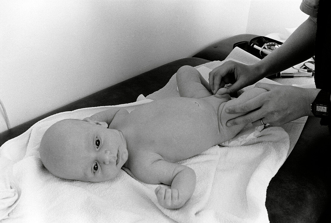 Paediatric examination of baby's testicles