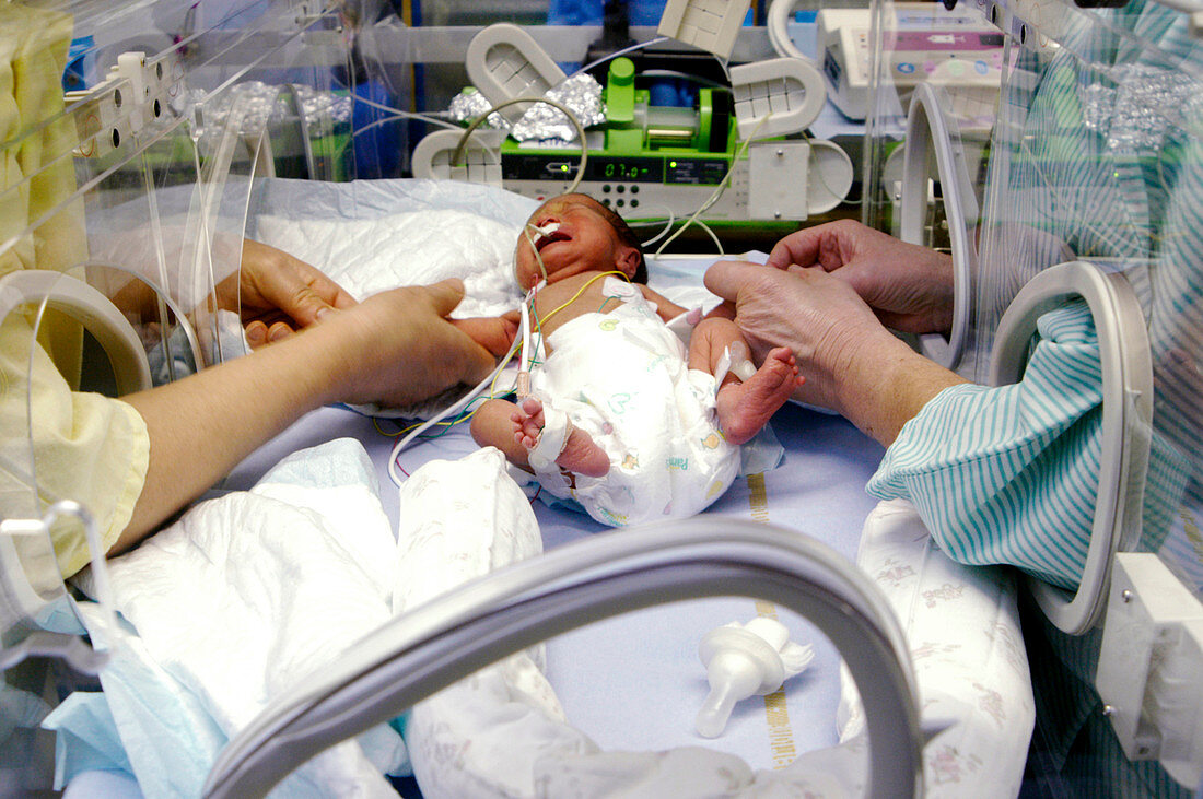 Jaundiced premature baby
