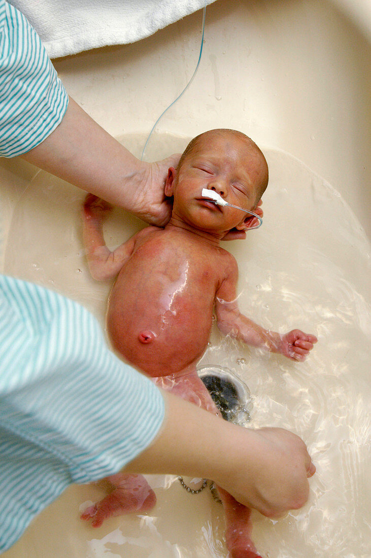 Nurse bathing a premature baby