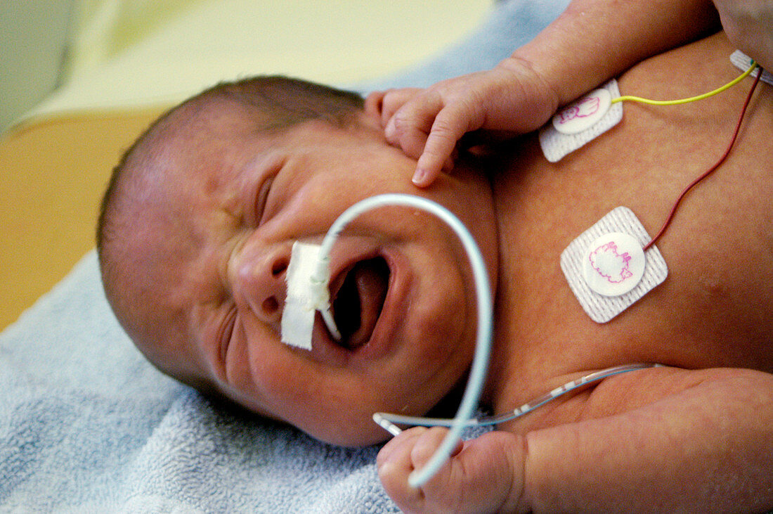 Premature baby crying