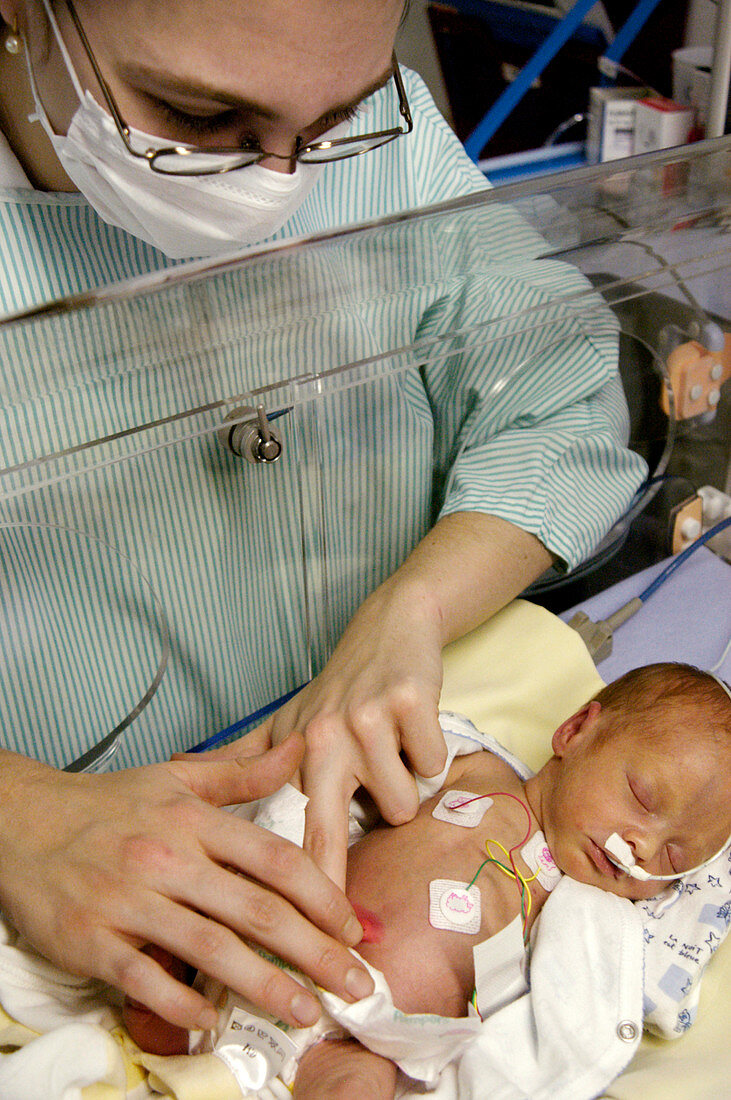 Doctor palpating a premature baby