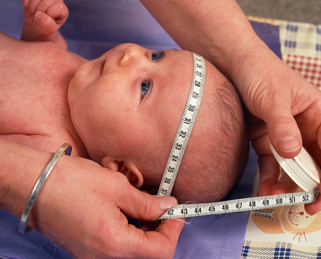 Head of a one month old baby girl being measured