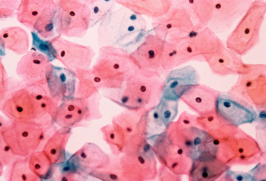 Light micrograph of normal cells in cervical smear
