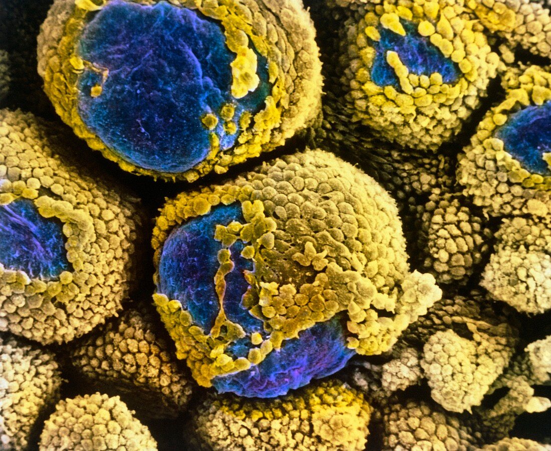 False-colour SEM of polycystic ovary