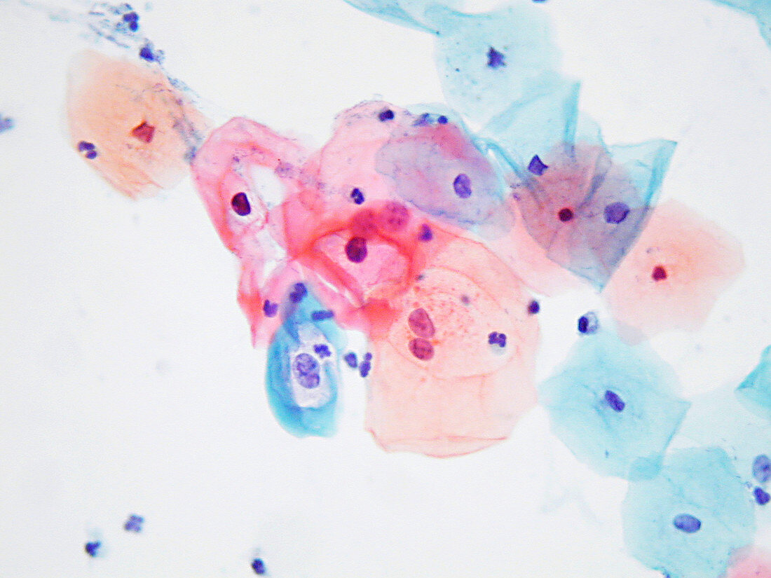 Human papillomavirus infected cells