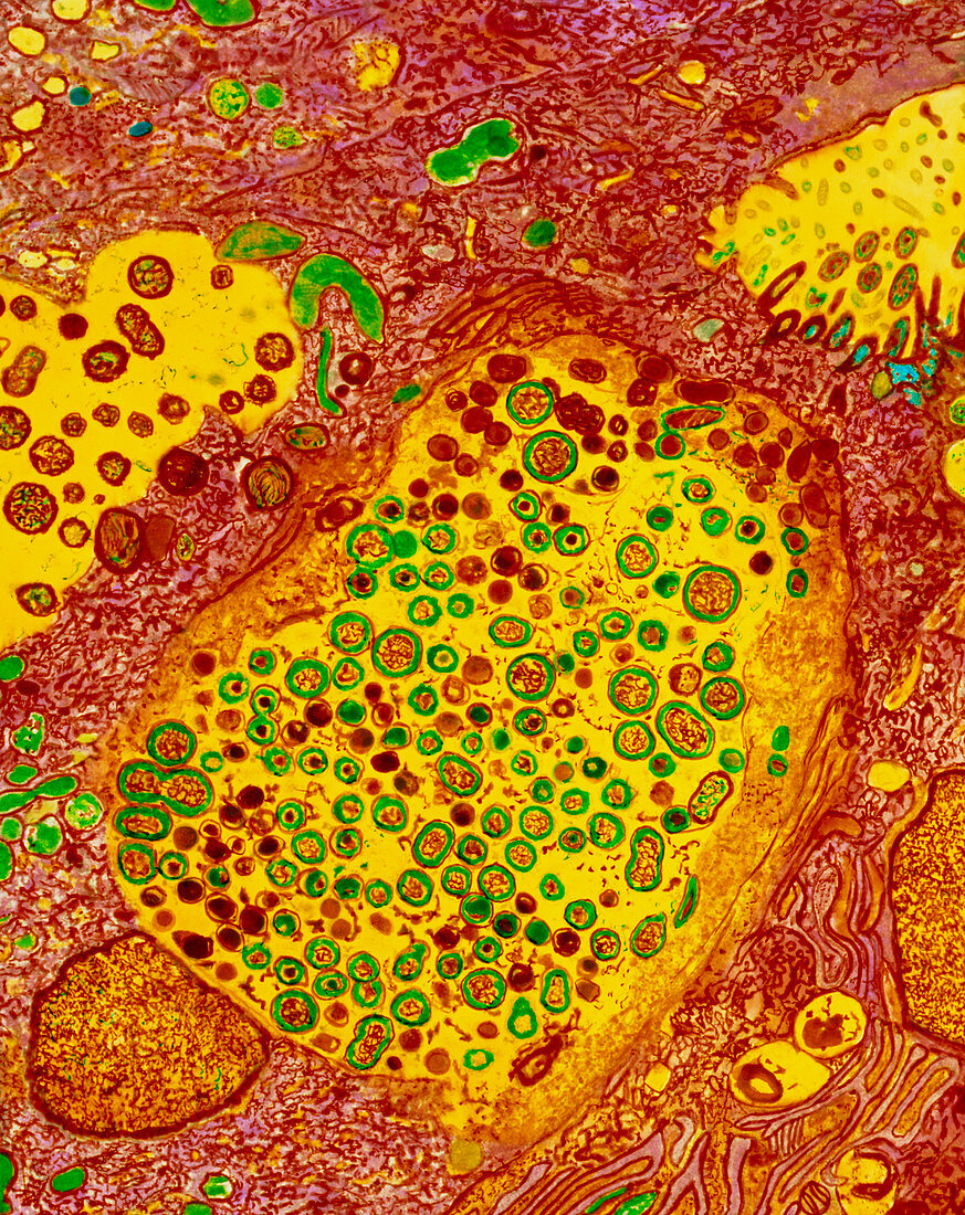 Colour TEM of fallopian cells in Chlamydia infect