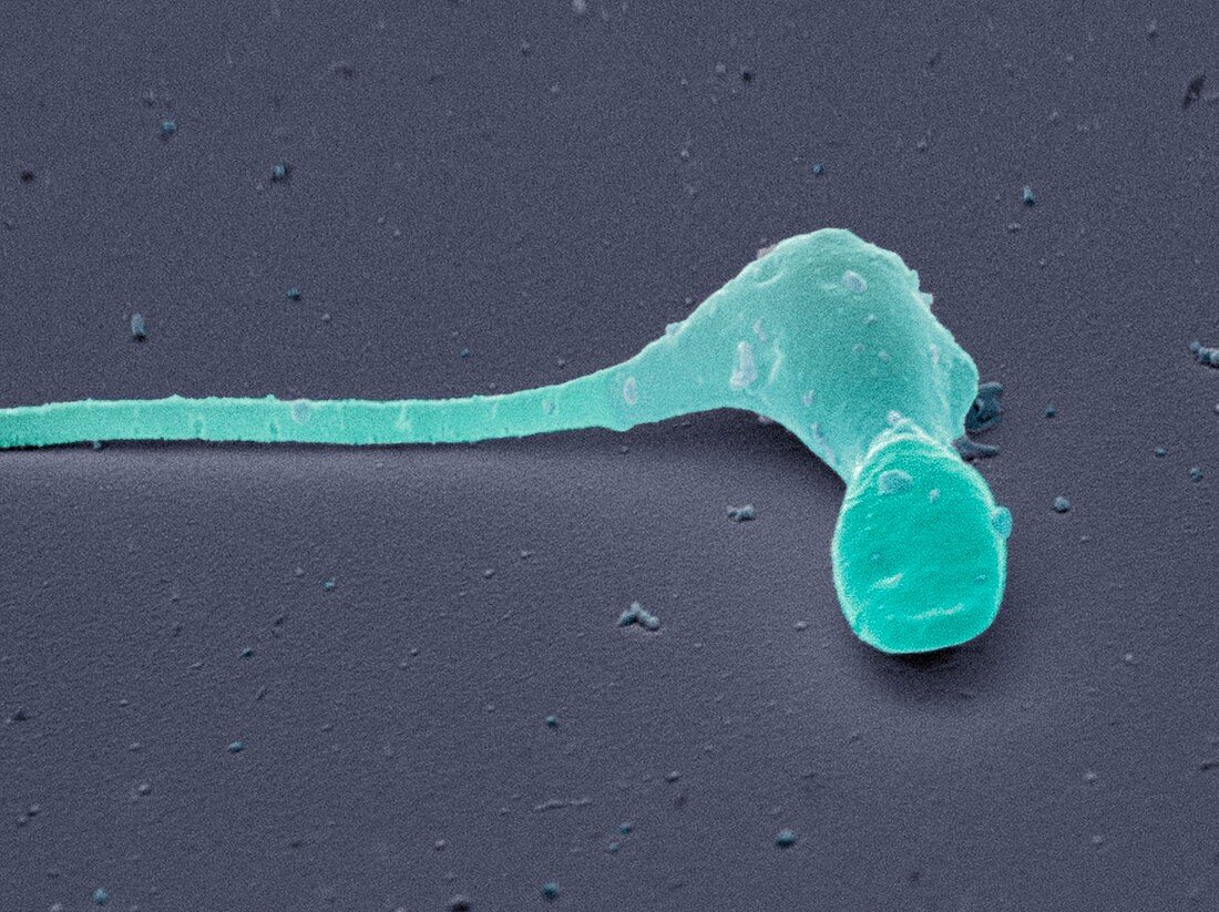 Deformed sperm cell,SEM