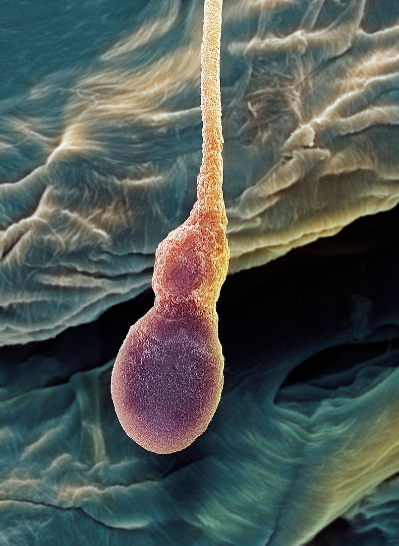 Deformed sperm cell,SEM