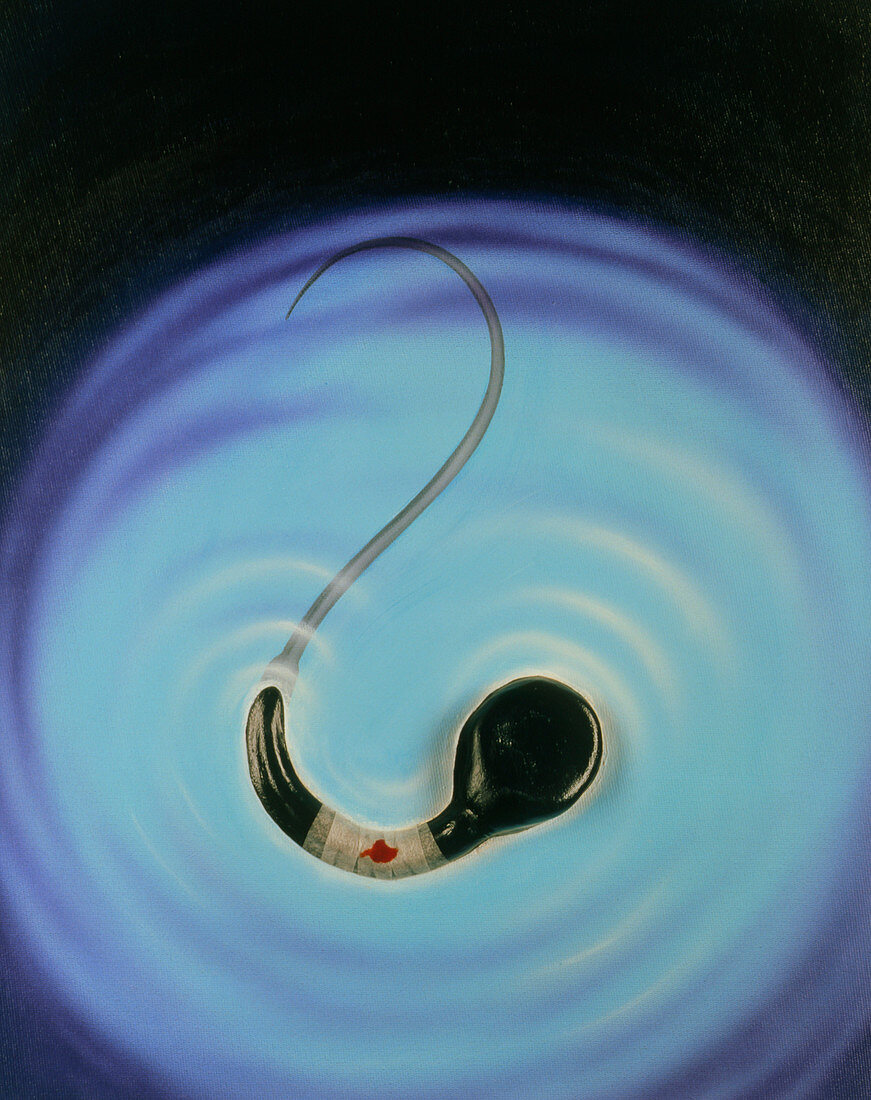 Infertility: Artwork of a sperm with bandage