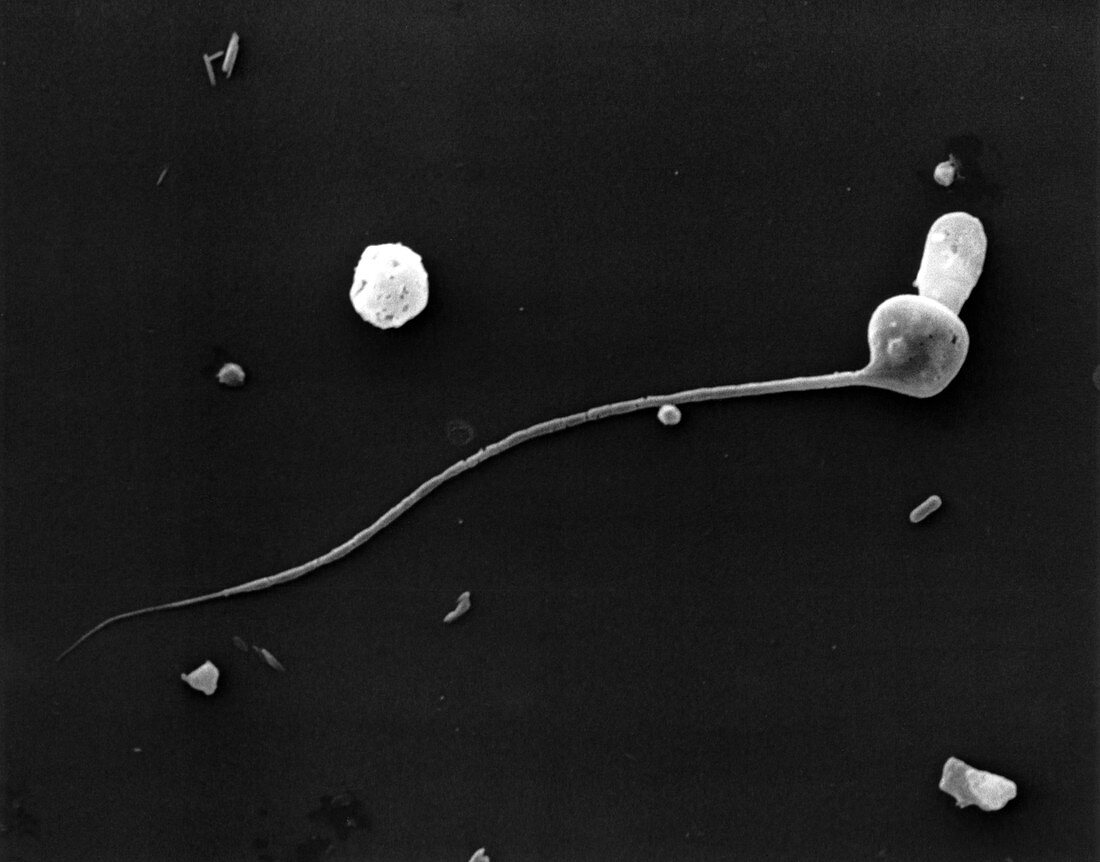 SEM showing deformed sperm