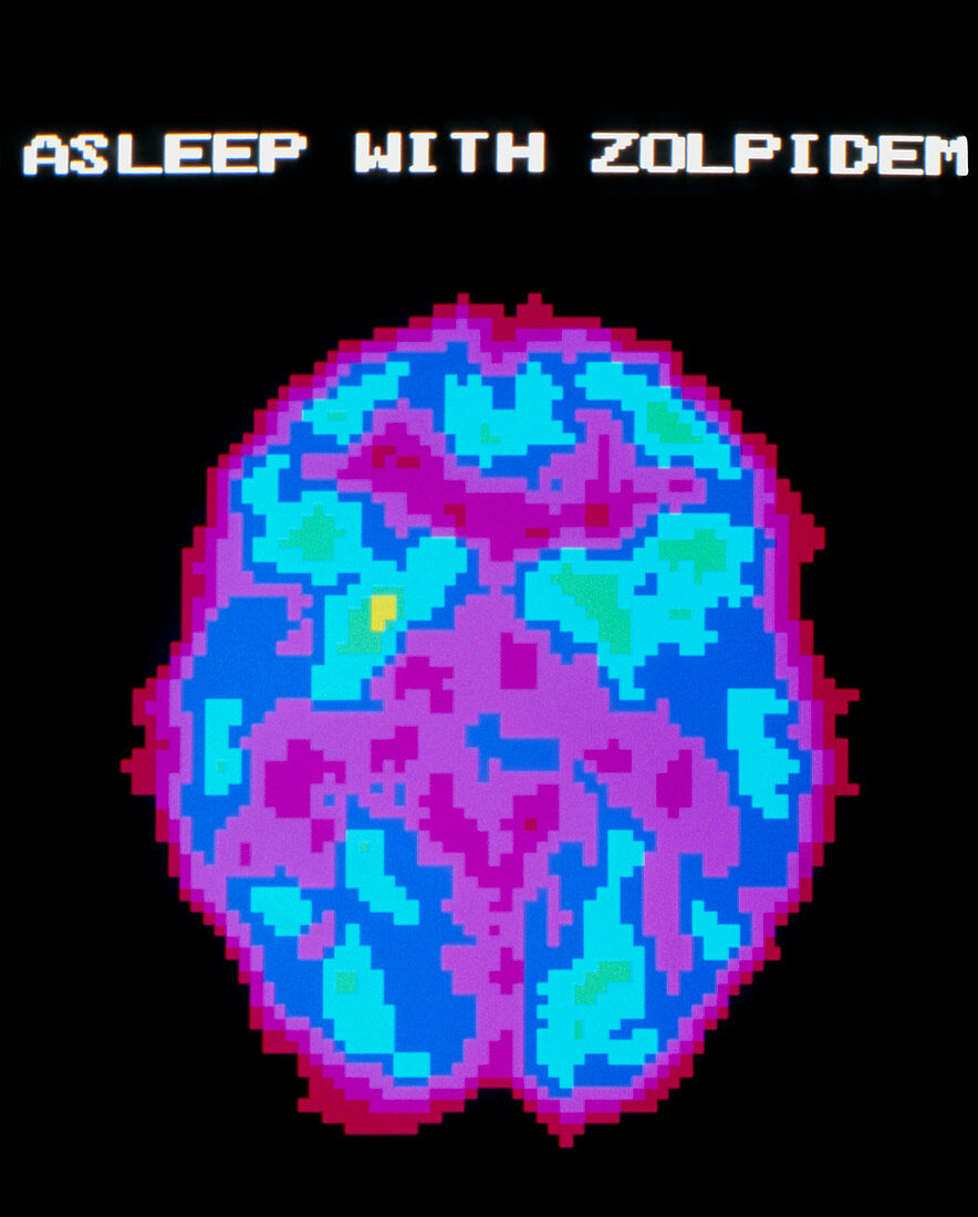 Coloured PET scan of brain during drugged sleep