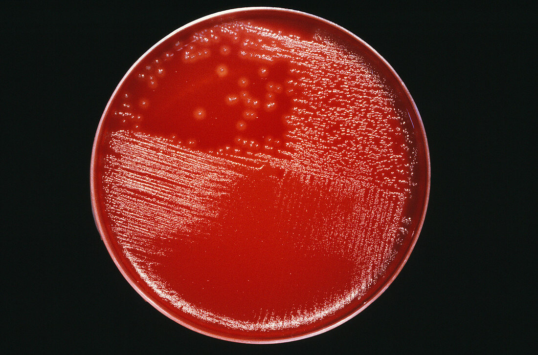 Cultured gas gangrene bacteria