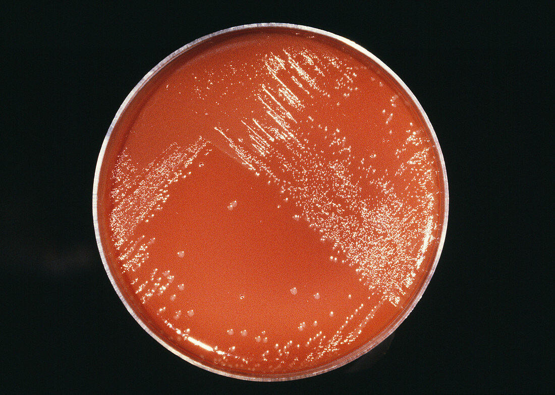 Cultured gonorrhoea bacteria